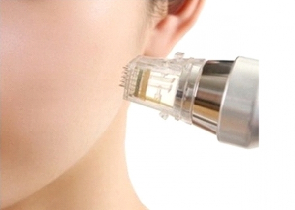 Mikrojehličková radiofrekvence